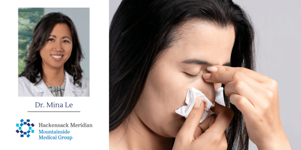 woman holding tissue to a bloody nose